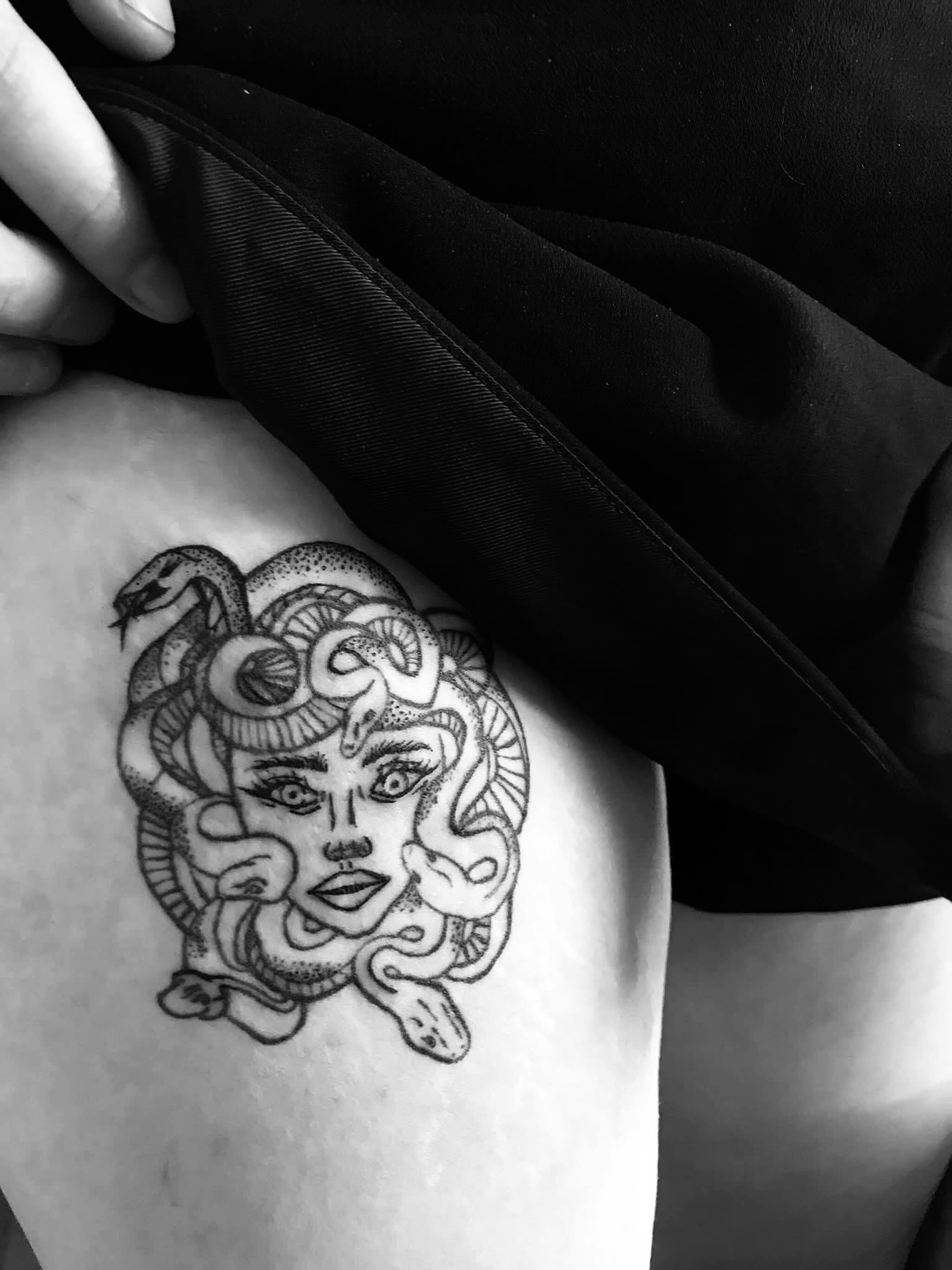 Medusa Head