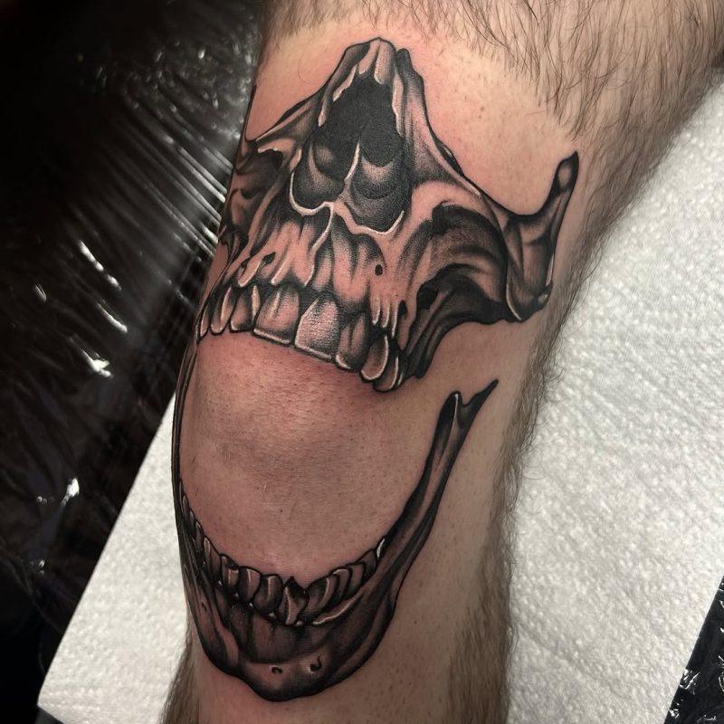 Open Skull