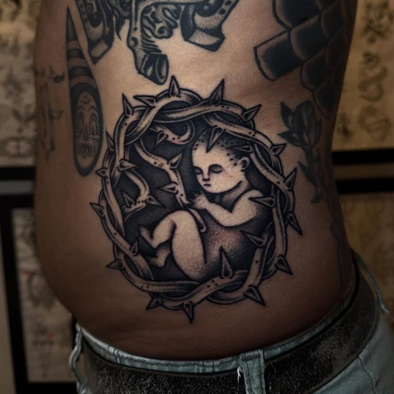 Fetal Thorn